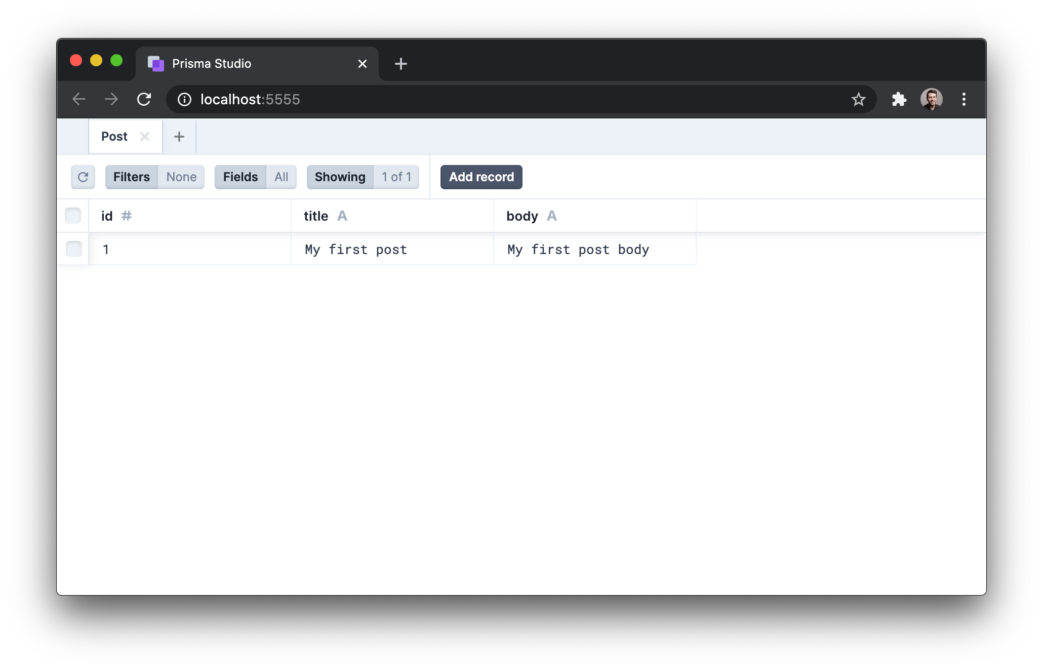 Prisma studio Post table